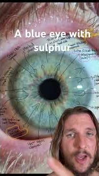 What Sulphur Looks Like in an Eye