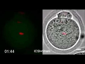Single nucleolus precursor body formation in the pronucleus of mouse zygotes and SCNT embryos