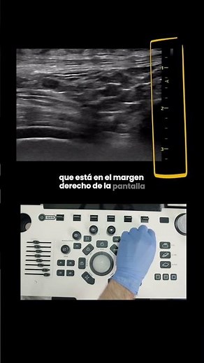 How to use the FOCUS on an ultrasound machine (Improve your images!) 🩺✨
