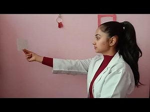 Hart chart therapy-NOSS