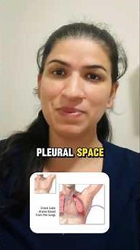 Chest Tube Drainage System Explained: Key Points for NCLEX & Clinicals