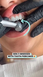 871K views · 2K reactions | Tooth piercings are the new nose rings  | Ultimate | Facebook
