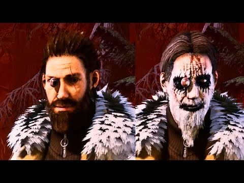 Jeffs Eyeball Pops In & Out Of It's Socket