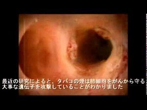 オーストラリア禁煙CM（日本語字幕付） 肺がん編