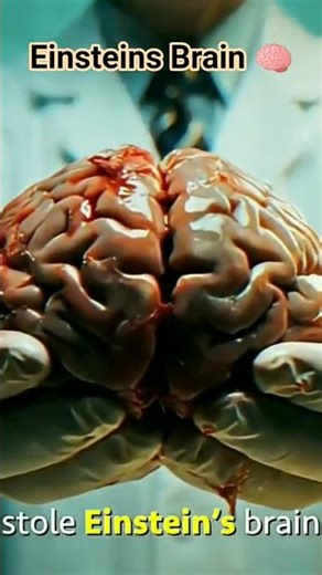 😱🧠 einsteins brain was stolen #einstein #einstein #brain #brainpower #facts #shorts #youtubeshorts