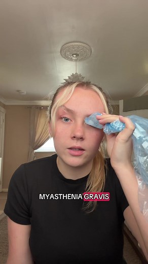 Understanding Blepharospasm and Myasthenia Gravis