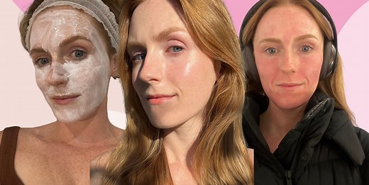 'I tried Potenza radiofrequency microneedling – here’s what it did to my skin'