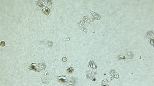 Colony Rotifera Synchaeta Sp Under Microscope Stock Footage Video (100% Royalty-free) 1103073393 | Shutterstock