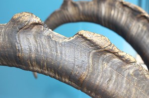 Doctors surgically remove cancerous 'horn' growing on the back of a UK man