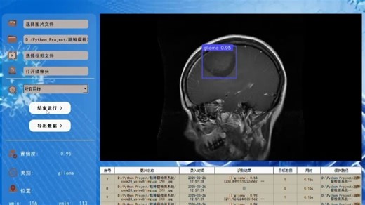 基于深度学习的脑肿瘤检测识别系统（UI界面、yolov8、Python代码、数据集）外接摄像头实时检测识别。 以官方yolov8为主干，实现对医学领域的四种脑