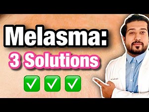 Melasma Treatment on ANY SKIN | How to Get Rid of Melasma Quick