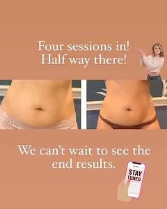 ULTRASOUND CAVITATION - body contouring is a breakthrough non-surgical technology that works to reduce stubborn areas of fat and cellulite. Treatments are painless, making them a popular body contouring alternative to surgery and liposuction. . . . #bodycontouring #ultrasoundcavitation #fatcavitationandskintightening #cellulitereduction #skintightening #luxseries #nonsurgicaltreatments #painless #sculptbody | Zeeman's | Facebook
