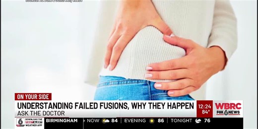 Ask The Doctor: Understanding failed fusions, why they happen