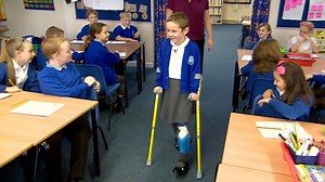 Girl, 8, walks into school on new prosthetic leg