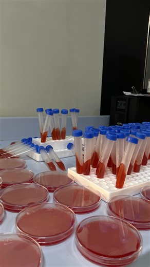 Zibeyda Gambarova | MD on Instagram: "We use novobiocin test for the identification of Staphylococcus saprophyticus @dr.zibeyda is a blog of a resident microbiologist where you’ll learn more about microorganisms 🧫"