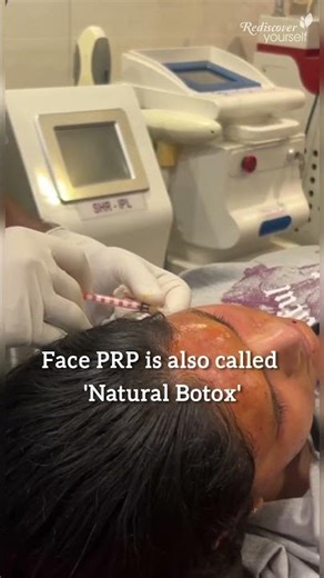 Natural Botox for your Skin - PRP!