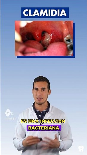 This is what CHLAMYDIA and GONORRHEA look like in the ORAL - STIs with symptoms and oral transmis...
