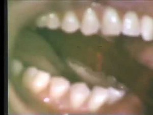 Oral Hygiene Methods - Toothbrushing and Flossing