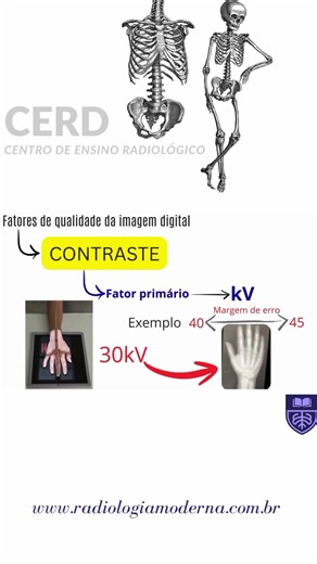 Errou kV / Técnicas Radiológicas