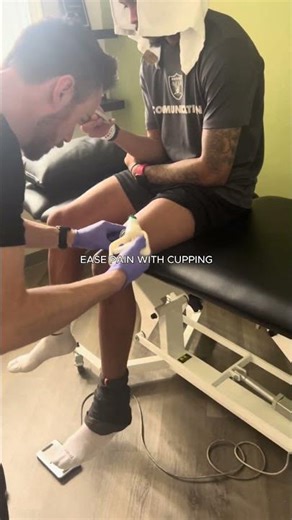 Cupping Therapy for Pain Relief – Las Vegas PT Tip
