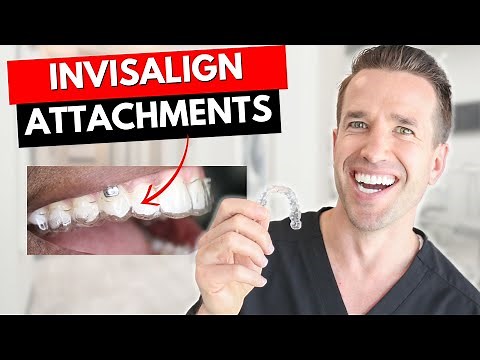 Don't get Invisalign Attachments Before watching this! | Dr. Nate