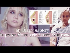 my rare diagnosis story: superior mesenteric artery syndrome