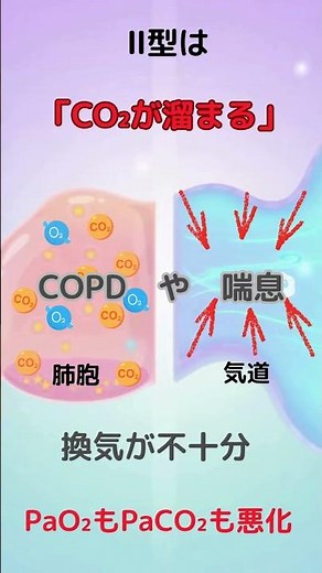「呼吸不全」1型と2型の違いを30秒で理解！酸素療法まで一気につながる#解剖生理学 #看護実習#呼吸器#呼吸不全#酸素療法#看護学生 #看護師国家試験 #肺炎 #COPD #喘息 #肺水腫 #国試対策
