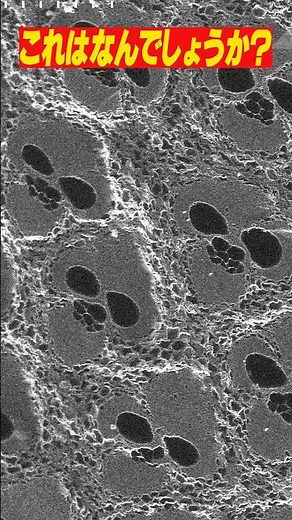 [Shocking] Aliens in the microscopic world. Can you guess what "this" found with an electron micr...