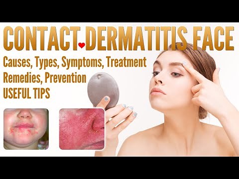 Contact Dermatitis Face Causes, Types, Symptoms, Treatment, Prevention, Home Remedies