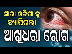 Understanding Common Eye Diseases : Causes, Symptoms and Treatments