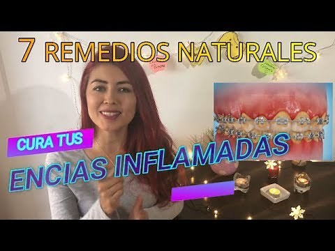 COMO CURAR ENCIAS INFLAMADAS REMEDIOS CASEROS PARA ENCIAS INFLAMADAS TRATAMIENTO PARA ENCIAS