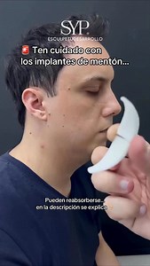🚨 Ten cuidado con los implantes faciales... La cirugía de mentón no siempre es el mejor camino para que tu mandíbula se vea mejor. Mucha gente se pone un implante para “marcar” el mentón y cambiar el perfil rápido... Pero eso no siempre arregla el problema de fondo: solo cambia la forma por fuera. El precio de los implantes puede superar los 5.000 a 15.000 dólares americanos, dependiendo del país y del profesional, y aunque se trate de un procedimiento significativo, la situación no es tan bene