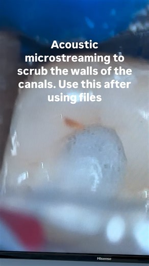 13K views · 14 reactions | Pro Tip- Using the Smart Lite Pro...