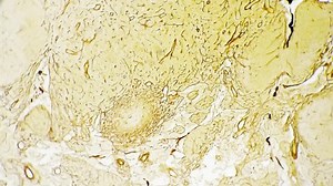 25 Reticular Texture Stock Video Footage - 4K and HD Video Clips | Shutterstock