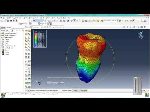 3D Modeling and Stress Analysis of tooth Using FEA(Abaqus)