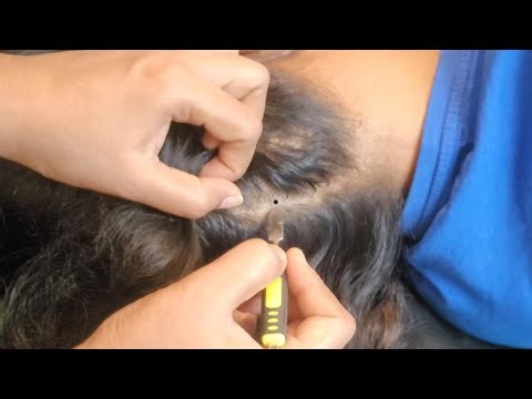 Scalp Check ASMR - The Most Relaxing Tingle Experience