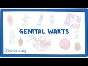 Sexual transmitted Disease/Definition, cause,sign and symptoms, treatment,and management