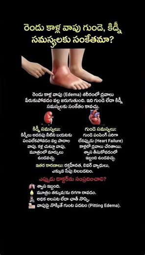 Leg Swelling Warning Signs | Edema Causes Explained | Kidney or Heart Problem? Know the Truth
