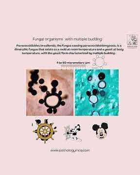 Invasive Fungal Infections — Histopathology Made Easy | Pathology resident| Pathologist | FRCPath