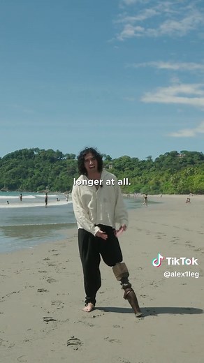 Challenges of Walking with a Peg Leg