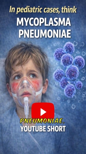 EM Major vs EM Minor—The Dangerous Difference #medical #dermatology