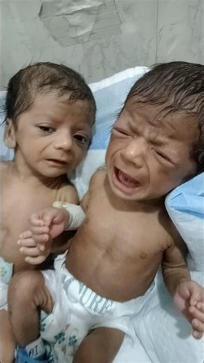 #NewbornFeeding#BabyFeeding#NICUBaby#NICUCare#NeonatalCare#BreastfeedingSupport#newborn