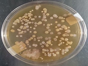 ONLINE Micro Lab 2: Ubiquity of Microorganisms, Culturing and Isolating Bacterial Colonies