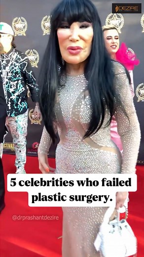 834K views · 3K reactions | 5 Celebrities Who Regret Their Plastic Surgeries  What Went Wrong? #PlasticSurgeryFails #CelebritySurgeryGoneWrong #AestheticAwareness #CosmeticSurgeryReality #WhatNotToDo #PlasticSurgeonReacts #DrPrashantDezire #BeautyGoneWrong #SurgeryRegret | Dezireclinic | Facebook