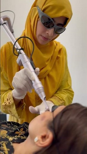 Instant Nevus & Mole Removal with Q-Switch Laser | Amazing Skin Transformation