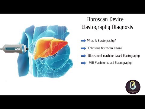 Fibroscan Device | Elastography | Biomedical Engineers TV |