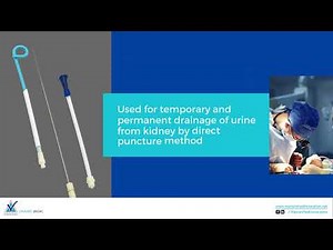 Features of Pigtail Nephrostomy Drainage Catheter With Trocar (PCN)