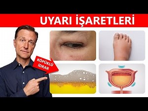 Böbrekleriniz sağlıklı mı? 10 erken uyarı işareti | Dr.Berg Türkçe