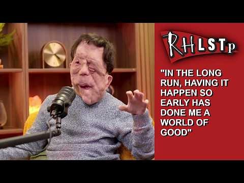 Adam Pearson on neurofibromatosis, and being a public disability rights activist - from RHLSTP 599