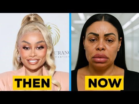 10 Black Actors Who Look HORRIBLE With Plastic Surgery